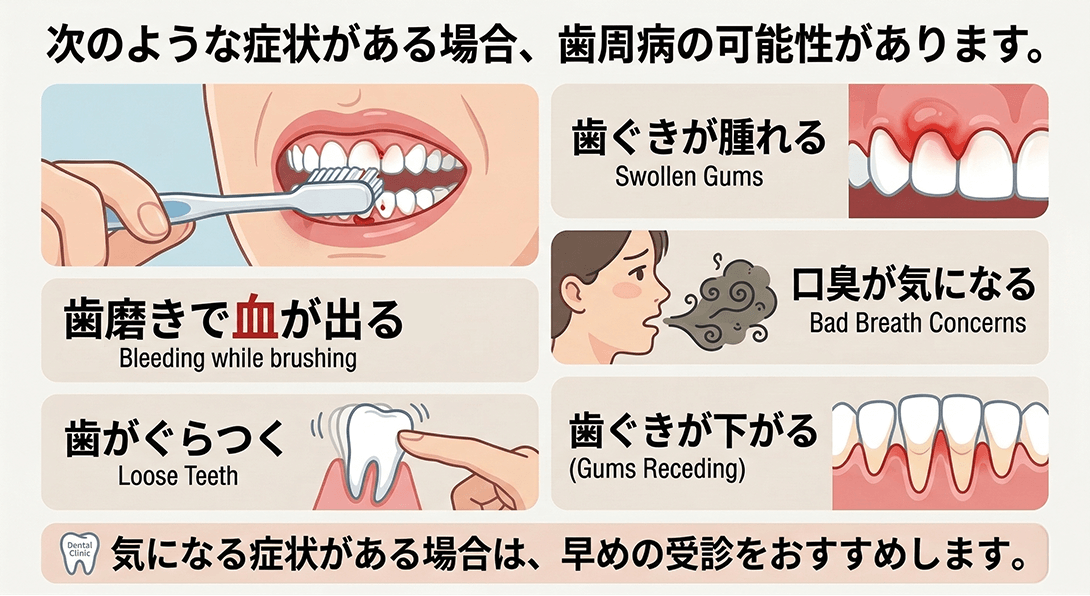 歯周病チェック